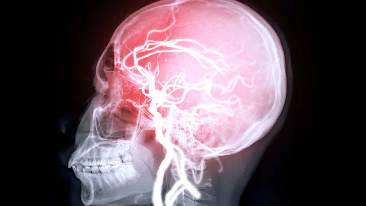 Connections Between Heart Health and Memory: Insights from New Research