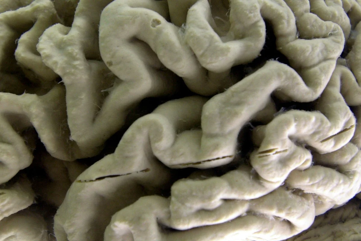 Blood Test for Alzheimer's Risk Shows Promising Results Ahead of Symptoms