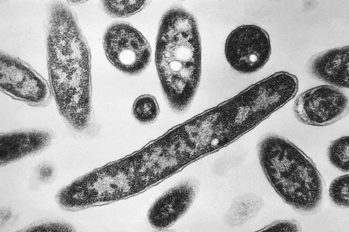 Resurgence of Legionnaires' Disease in NYC: Key Insights and Ongoing Investigations